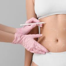 What to Know Before Booking Mommy Makeover Surgery in the South Bay with Adonis Plastic Surgery